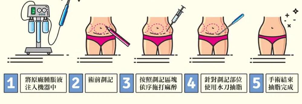 最新吸脂手术方法深度解析与解析✨
